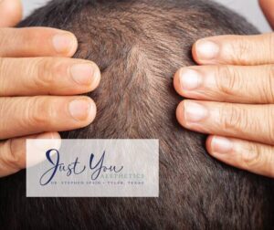 image of dr looking at thinning hair